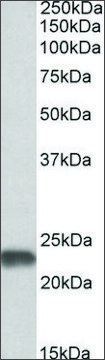 Anti-SOD2 antibody produced in goat affinity isolated antibody, buffered aqueous solution