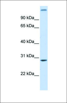 Anti-ALKBH2 antibody produced in rabbit affinity isolated antibody