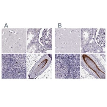 Anti-TCHHL1 antibody produced in rabbit Prestige Antibodies&#174; Powered by Atlas Antibodies, affinity isolated antibody, buffered aqueous glycerol solution