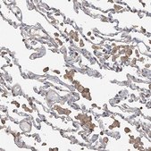 Anti-SLC43A3 antibody produced in rabbit Prestige Antibodies&#174; Powered by Atlas Antibodies, affinity isolated antibody, buffered aqueous glycerol solution