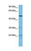 Anti-PAX3 antibody produced in rabbit affinity isolated antibody