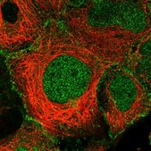 Anti-PALM antibody produced in rabbit Prestige Antibodies&#174; Powered by Atlas Antibodies, affinity isolated antibody, buffered aqueous glycerol solution