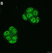 Anti-Ubiquilin 4 Antibody, clone 5K6 ZooMAb&#174; Rabbit Monoclonal recombinant, expressed in HEK 293 cells