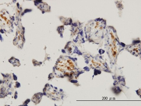 ANTI-MKNK1 antibody produced in mouse clone 2H8, purified immunoglobulin, buffered aqueous solution