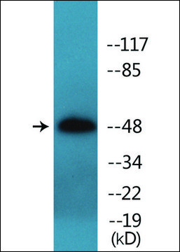 Anti-phospho-IL-13R &#945;1 (pTyr405) antibody produced in rabbit affinity isolated antibody