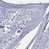 Anti-LAMP5 antibody produced in rabbit Prestige Antibodies&#174; Powered by Atlas Antibodies, affinity isolated antibody, buffered aqueous glycerol solution