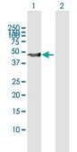 Anti-SKP2 antibody produced in mouse purified immunoglobulin, buffered aqueous solution