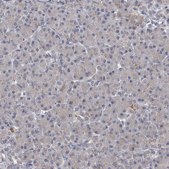 Anti-ALDH5A1 antibody produced in rabbit Prestige Antibodies&#174; Powered by Atlas Antibodies, affinity isolated antibody, buffered aqueous glycerol solution, ab1