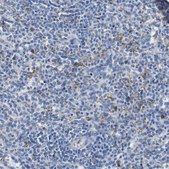 Anti-IGSF8 antibody produced in rabbit Prestige Antibodies&#174; Powered by Atlas Antibodies, affinity isolated antibody, buffered aqueous glycerol solution