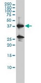 Monoclonal Anti-REN antibody produced in mouse clone 2H2, purified immunoglobulin, buffered aqueous solution