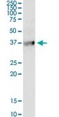 Monoclonal Anti-BDKRB1 antibody produced in mouse clone 3A2, purified immunoglobulin, buffered aqueous solution