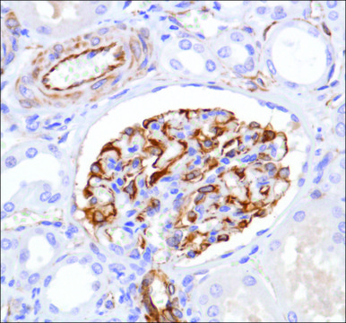 Anti-Nestin antibody, Rabbit monoclonal clone SP103, recombinant, expressed in proprietary host, affinity isolated antibody