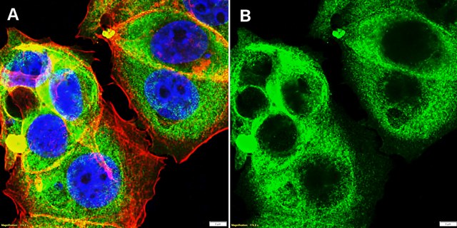 Anti-ARPC5 Antibody, clone 1H16 ZooMAb&#174; Rabbit Monoclonal recombinant, expressed in HEK 293 cells