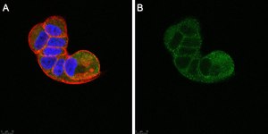 Anti-TSG101 Antibody, clone 2H18 ZooMAb&#174; Rabbit Monoclonal recombinant, expressed in HEK 293 cells