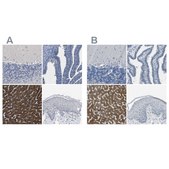 Anti-CYP2C8 antibody produced in rabbit Prestige Antibodies&#174; Powered by Atlas Antibodies, affinity isolated antibody, buffered aqueous glycerol solution