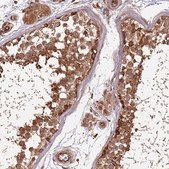 Anti-ACVR2A antibody produced in rabbit Prestige Antibodies&#174; Powered by Atlas Antibodies, affinity isolated antibody, buffered aqueous glycerol solution