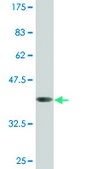 Monoclonal Anti-DPYSL4 antibody produced in mouse clone 1F5, purified immunoglobulin, buffered aqueous solution
