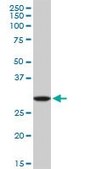 Anti-RNASEH2A antibody produced in mouse purified immunoglobulin, buffered aqueous solution