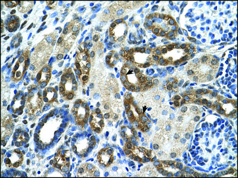 Anti-PKLR antibody produced in rabbit IgG fraction of antiserum