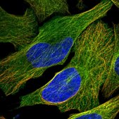 Anti-KIF26B antibody produced in rabbit Prestige Antibodies&#174; Powered by Atlas Antibodies, affinity isolated antibody, buffered aqueous glycerol solution, ab4
