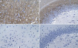 Anti-VGLUT1 Antibody, clone 3C10.2 ZooMAb&#174; Mouse Monoclonal recombinant, expressed in HEK 293 cells