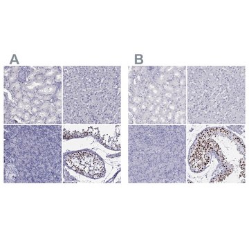 Anti-STAG3 antibody produced in rabbit Prestige Antibodies&#174; Powered by Atlas Antibodies, affinity isolated antibody, buffered aqueous glycerol solution