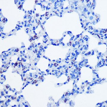 Anti-CBS antibody produced in rabbit