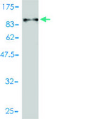Monoclonal Anti-ALB antibody produced in mouse clone 1G12-1B3, purified immunoglobulin, buffered aqueous solution