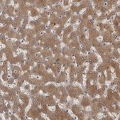 Anti-FGFR4 antibody produced in rabbit Prestige Antibodies&#174; Powered by Atlas Antibodies, affinity isolated antibody, buffered aqueous glycerol solution
