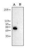 Anti-Potassium Channel Kv1.1 Antibody Chemicon&#174;, from rabbit