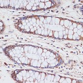 Anti-CDKN2A/p16INK4a antibody produced in rabbit