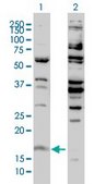 Monoclonal Anti-H3F3B antibody produced in mouse clone 2D7-H1, purified immunoglobulin, buffered aqueous solution