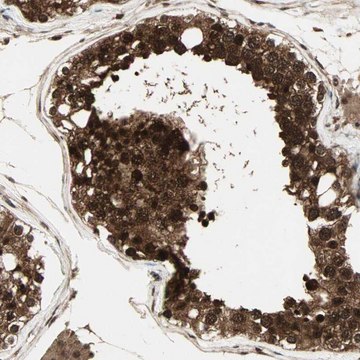 Anti-CSNK2B antibody produced in rabbit Prestige Antibodies&#174; Powered by Atlas Antibodies, affinity isolated antibody, buffered aqueous glycerol solution