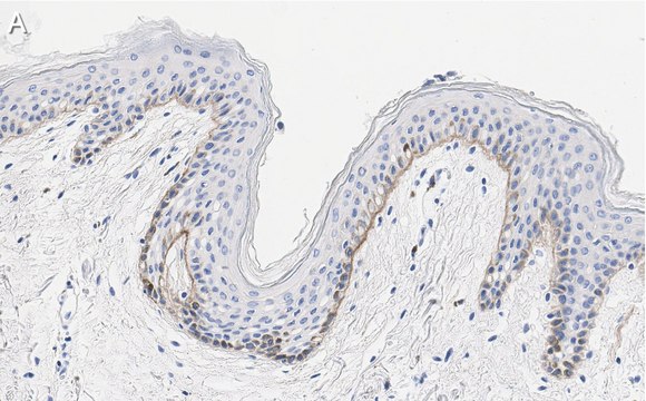 Anti-Laminin-5 &#947;2 Antibody, clone D4B5 ZooMAb&#174; Mouse Monoclonal recombinant, expressed in HEK 293 cells