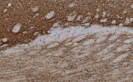 Anti-VGluT1 Antibody, clone 4O15, ZooMAb&#174; Rabbit Monoclonal recombinant, expressed in HEK 293 cells