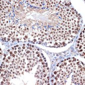Anti-HMGB2 antibody produced in rabbit