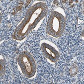 Anti-VPS41 antibody produced in rabbit Prestige Antibodies&#174; Powered by Atlas Antibodies, affinity isolated antibody, buffered aqueous glycerol solution, Ab2
