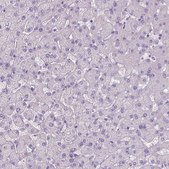Anti-MAPT antibody produced in rabbit Prestige Antibodies&#174; Powered by Atlas Antibodies, affinity isolated antibody, buffered aqueous glycerol solution
