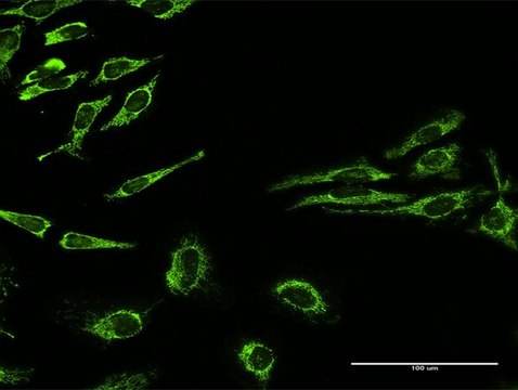 Anti-HSPD1 antibody produced in rabbit purified immunoglobulin, buffered aqueous solution