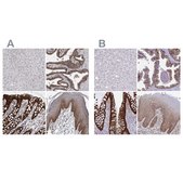 Anti-LIMA1 antibody produced in rabbit Prestige Antibodies&#174; Powered by Atlas Antibodies, affinity isolated antibody, buffered aqueous glycerol solution