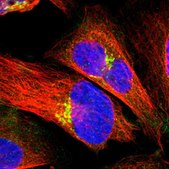 Anti-PDE8A antibody produced in rabbit Prestige Antibodies&#174; Powered by Atlas Antibodies, affinity isolated antibody, buffered aqueous glycerol solution