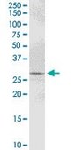 Anti-PYCR1 antibody produced in mouse purified immunoglobulin, buffered aqueous solution