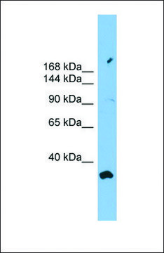 Anti-PACS2 antibody produced in rabbit affinity isolated antibody