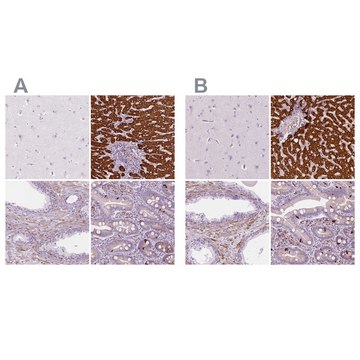 Anti-CES1 antibody produced in rabbit Prestige Antibodies&#174; Powered by Atlas Antibodies, affinity isolated antibody, buffered aqueous glycerol solution