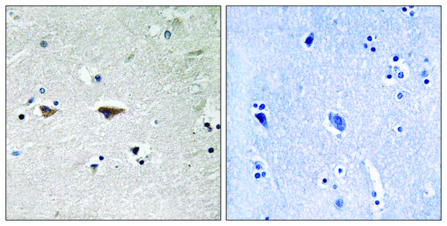 Anti-SRC, N-Terminal antibody produced in rabbit affinity isolated antibody