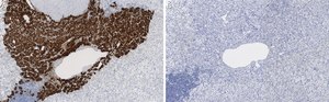 Anti-Dopamine &#946; Hydroxylase Antibody, clone 2B11 ZooMAb&#174; Rabbit Monoclonal recombinant, expressed in HEK 293 cells