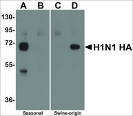 Anti-Seasonal H1N1 Hemagglutinin antibody produced in rabbit affinity isolated antibody, buffered aqueous solution