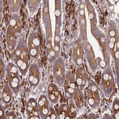 Anti-OSBPL2 antibody produced in rabbit Prestige Antibodies&#174; Powered by Atlas Antibodies, affinity isolated antibody, buffered aqueous glycerol solution