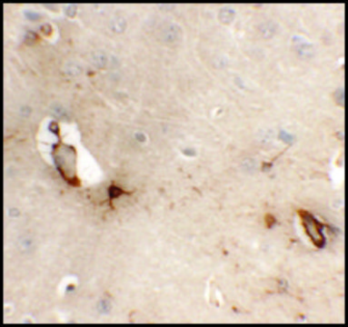 Anti-TMEM204 antibody produced in rabbit affinity isolated antibody