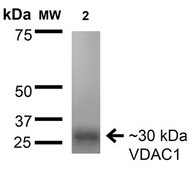 Monoclonal Anti-Shank1/Shank3 - Fitc antibody produced in mouse clone S367-51, purified immunoglobulin